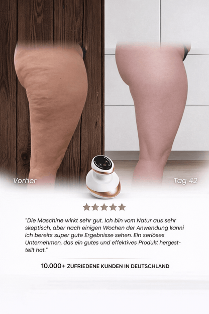Celluviaa 4-in-1 Massager