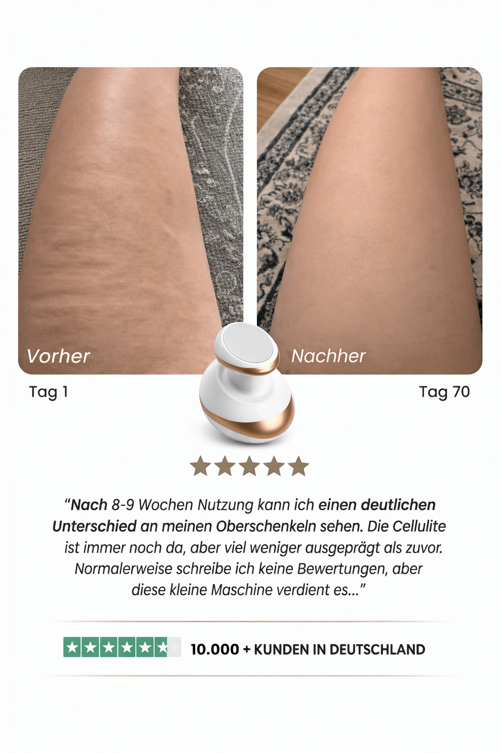 Celluviaa 4-in-1 Massager