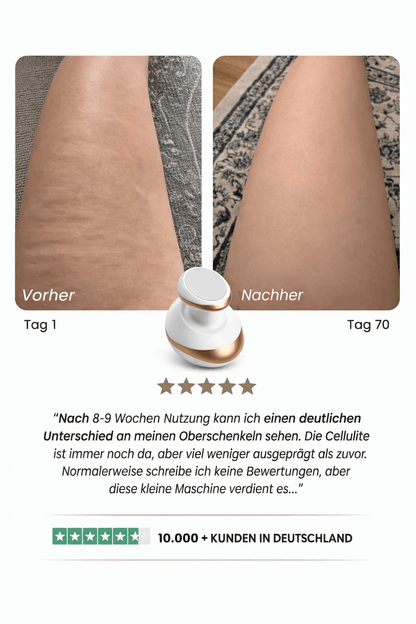 Celluviaa 4-in-1 Massager